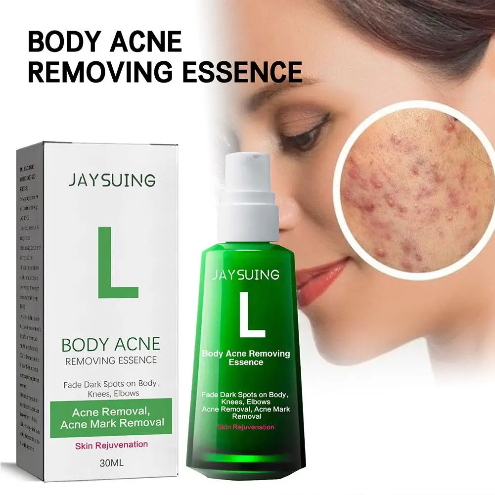 30ml Acne Remover Face Serum Herbs Acne Treatment Pimple Remover Skin Pores Acne Control Face Care Shrink Oil Herb G9P3
30ml Acne Remover Face Serum Herbs Acne Treatment Pimple Remover Skin Pores Acne Control Face Care Shrink Oil Herb G9P3