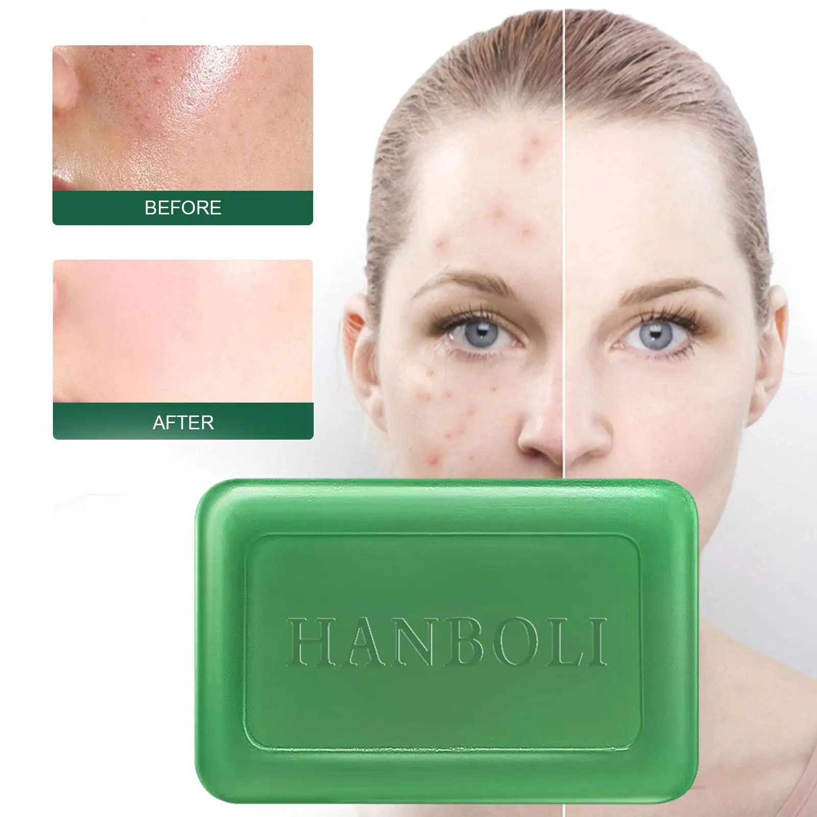 Wormwood Soap Antifungal Itching Mite Blackhead Acne Skin Control Soap Oil Care Face Body Soap Cleansing Remove Body Bath S H2R8
Wormwood Soap Antifungal Itching Mite Blackhead Acne Skin Control Soap Oil Care Face Body Soap Cleansing Remove Body Bath S H2R8
