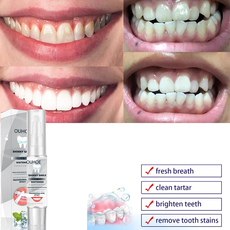 Стоматологическая ручка для ухода за зубами, отбеливание, удаление пятен, свежее дыхание, стоматологические инструменты, отбеливатель 
Стоматологическая ручка для ухода за зубами, отбеливание, удаление пятен, свежее дыхание, стоматологические инструменты, отбеливатель