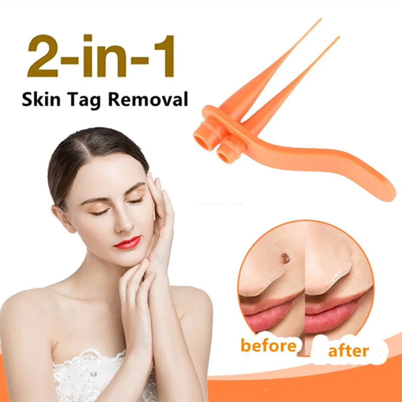 Home Use Skin Tag Remover Kit For 2-7 mm Mole Wart Remove Tool Skin Tag Removal Kit With Cleansing Swabs Facial Beauty Tool
Home Use Skin Tag Remover Kit For 2-7 mm Mole Wart Remove Tool Skin Tag Removal Kit With Cleansing Swabs Facial Beauty Tool