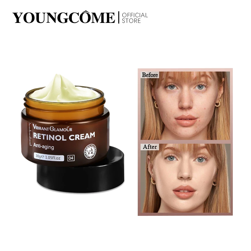 Retinol Face Cream Anti-Aging Anti-Wrinkle Remove Wrinkle Firming Lifting Whitening Brightening Moisturizing Facial Skin Care
Retinol Face Cream Anti-Aging Anti-Wrinkle Remove Wrinkle Firming Lifting Whitening Brightening Moisturizing Facial Skin Care