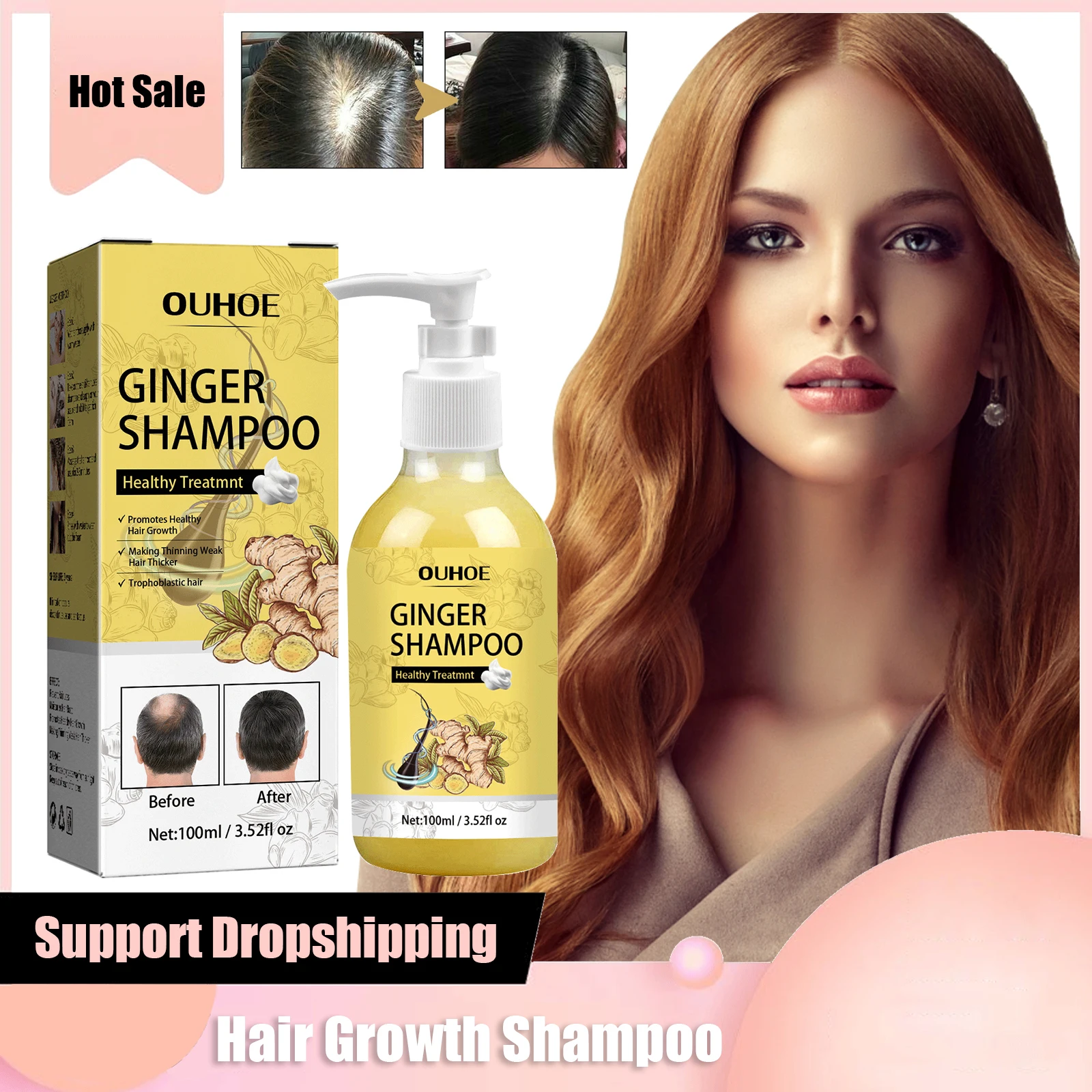 

Ginger Hair Growth Shampoo Strong Root Nutrients Scalp Care Anti Dandruff Itching Damage Repair Anti Hair Loss Treatment Shampoo