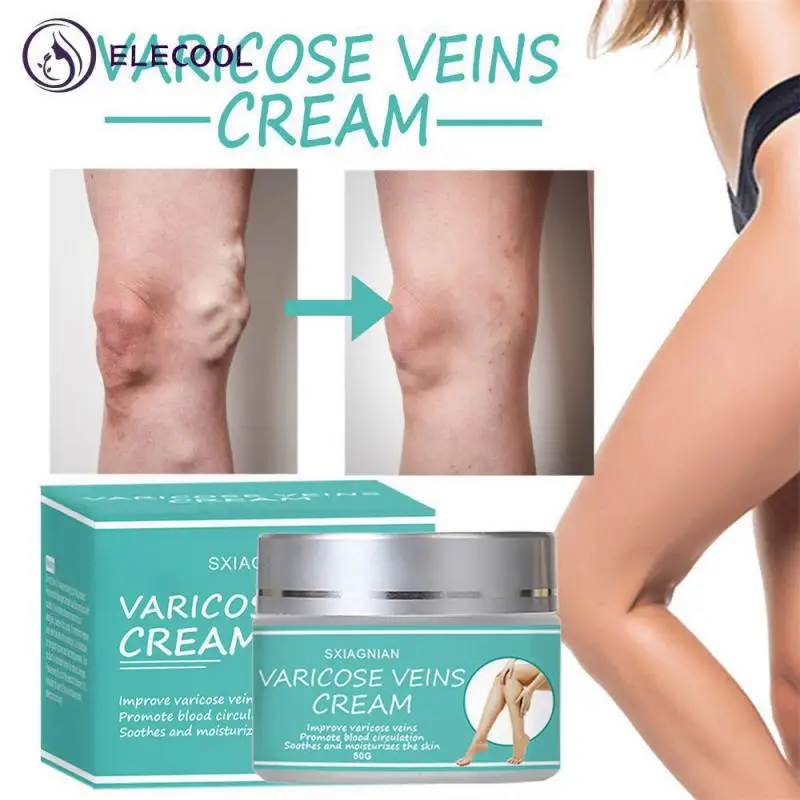 Эффективное лечение, терапевтический внутривенный крем, облегчение боли в венах, натуральные ингредиенты, уход за ногами, бальзам для кровеносных сосудов, здоровье, усиление кожи
Эффективное лечение, терапевтический внутривенный крем, облегчение боли в венах, натуральные ингредиенты, уход за ногами, бальзам для кровеносных сосудов, здоровье, усиление кожи