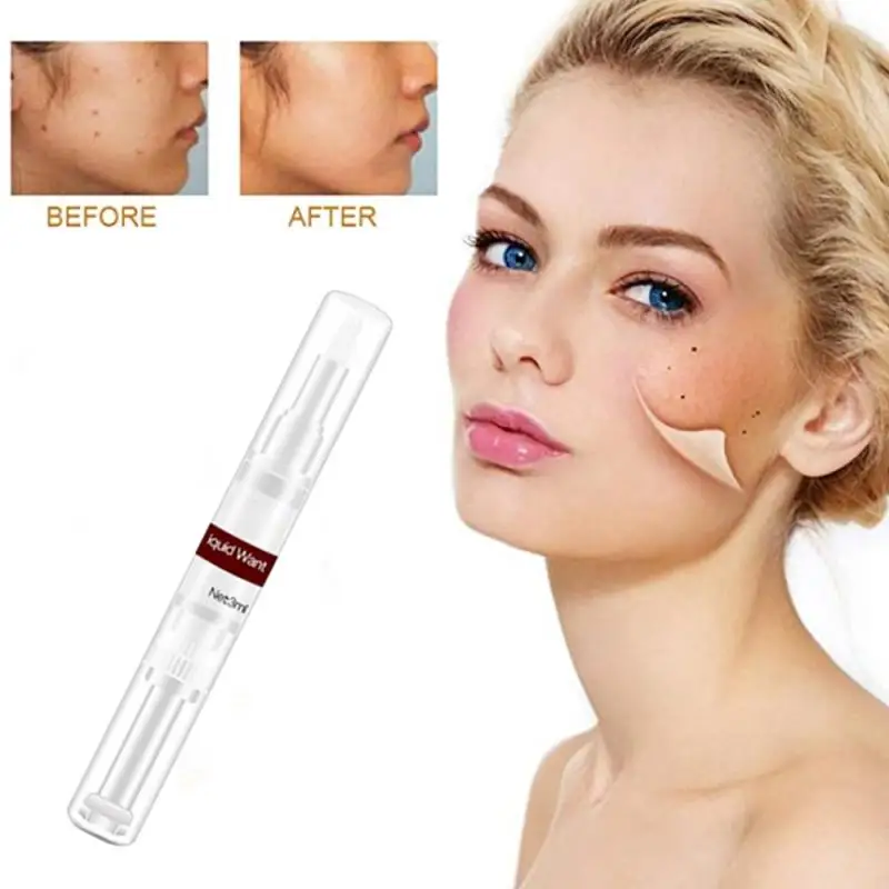 3ml Moles And Tag Removal Wiper Wipe Off Tags Liquid Remover Blemish Wart Removal Pen Face Body Skin Care TSLM1
3ml Moles And Tag Removal Wiper Wipe Off Tags Liquid Remover Blemish Wart Removal Pen Face Body Skin Care TSLM1