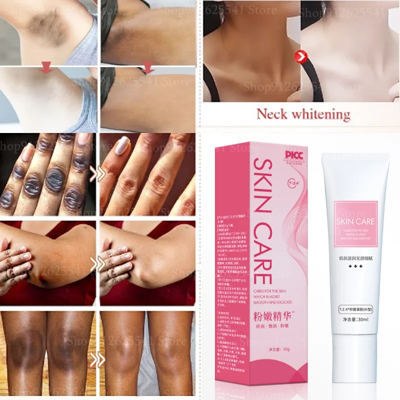 Intimate Area Pink Essence Private Parts Underarm Bleaching Serum Knee Butt Dullness Brighten Improve Lip Body Whitening Cream
Intimate Area Pink Essence Private Parts Underarm Bleaching Serum Knee Butt Dullness Brighten Improve Lip Body Whitening Cream