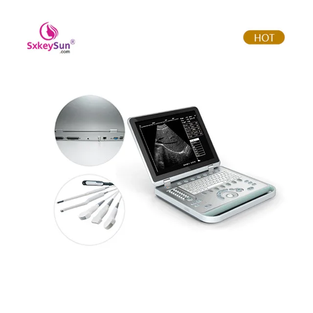 2020 Laptop UItrasound scannerVeterinary ultrasound equipment Mini Handheld Digital PalmSmart Veterinary B&W Ultrasound machine
2020 Laptop UItrasound scannerVeterinary ultrasound equipment Mini Handheld Digital PalmSmart Veterinary B&W Ultrasound machine