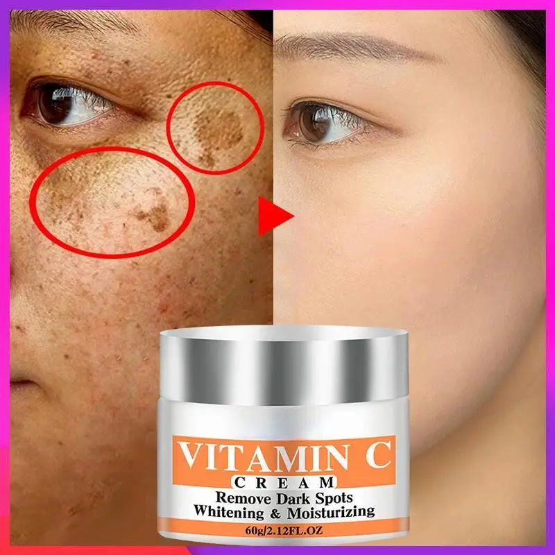 Newest Vitamin C Whitening Facial Cream Repair Fade Freckles Remove Dark Spots Melanin Remover Brightening Face Cream 
Newest Vitamin C Whitening Facial Cream Repair Fade Freckles Remove Dark Spots Melanin Remover Brightening Face Cream