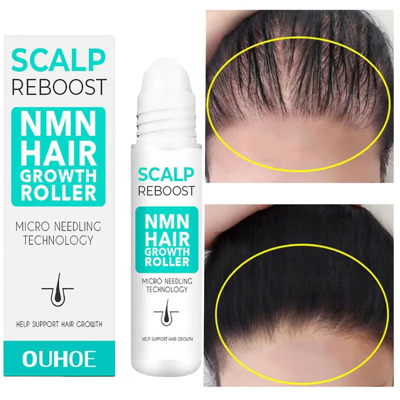 Fast Hair Growth Serum Anti Hair Loss Roller Massage Scalp Essence Prevent Baldness Nourishing Root Hair Thinning Treatment 18ML
Fast Hair Growth Serum Anti Hair Loss Roller Massage Scalp Essence Prevent Baldness Nourishing Root Hair Thinning Treatment 18ML
