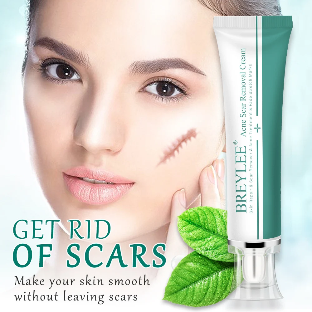 BREYLE Acne Scar Removal Cream Acne Spots Treatment Stretch Marks Burn Surgical Scar Repair Cream Smoothing Whitening Skin Care
BREYLE Acne Scar Removal Cream Acne Spots Treatment Stretch Marks Burn Surgical Scar Repair Cream Smoothing Whitening Skin Care