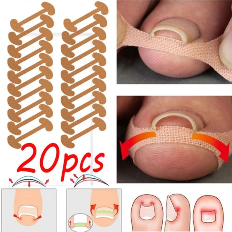 20pcs Professional Ingrown Toenail Foot Corrector Stickers Elasticity Toe Nail Care Pedicure Tools Health Care Protects Toe Nail
20pcs Professional Ingrown Toenail Foot Corrector Stickers Elasticity Toe Nail Care Pedicure Tools Health Care Protects Toe Nail