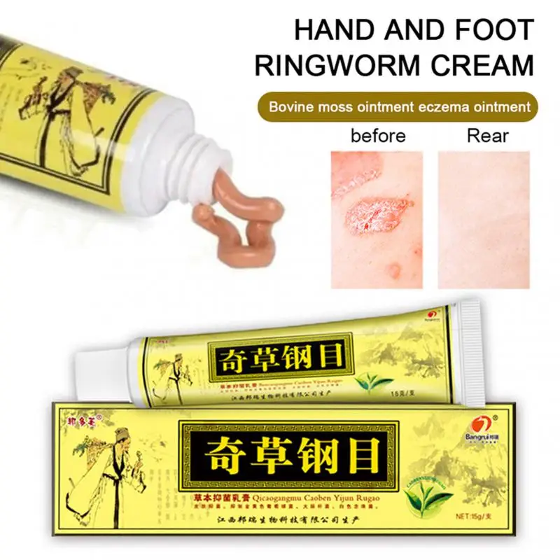 

10 Pcs Advanced Body Psoriasis Cream for Dermatitis and Eczema Pruritus Psoriasis Ointment Herbal Creams Health Care