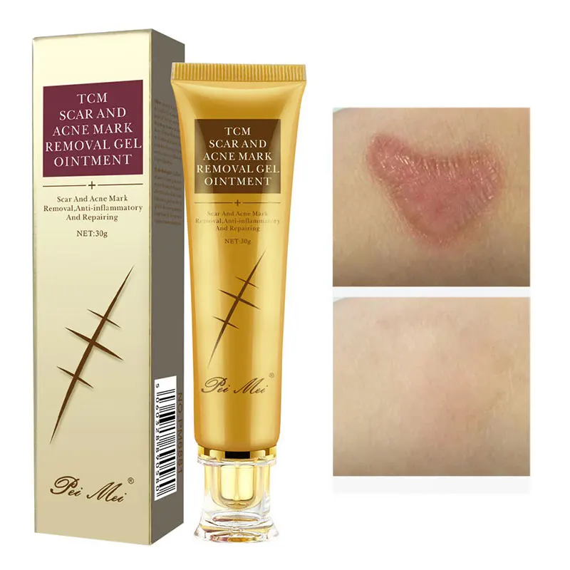Scar Removal Cream Gel Moisturizing Remove Stretch Mark Surgery Calming Repair Nourishing Trehalose Allantoin Body Skin Care 30g
Scar Removal Cream Gel Moisturizing Remove Stretch Mark Surgery Calming Repair Nourishing Trehalose Allantoin Body Skin Care 30g