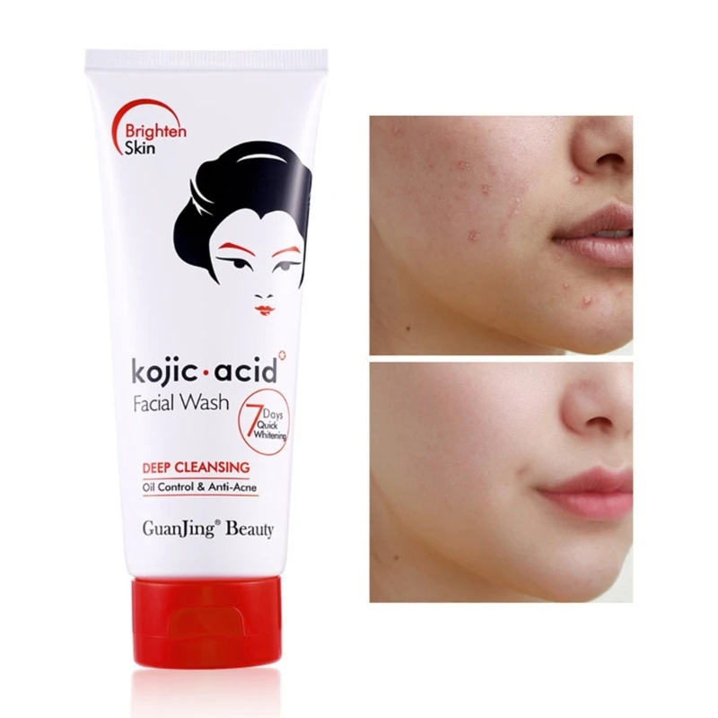Kojic Acid Skin Care Product Wash Face Cream Sunscreen Soap Body Lotion Toner Optional Drop Shipping
Kojic Acid Skin Care Product Wash Face Cream Sunscreen Soap Body Lotion Toner Optional Drop Shipping