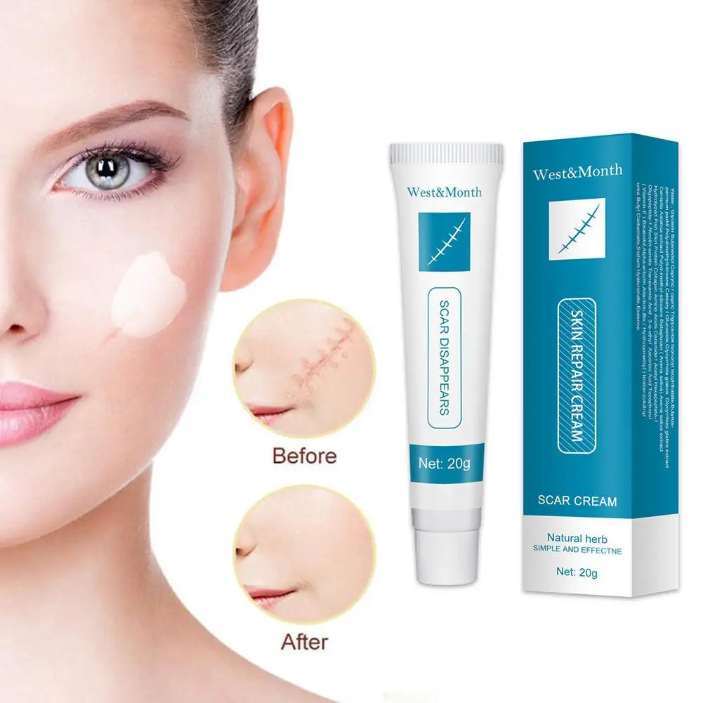 Genuine Scar Repair Cream Acne Scars Remove Gel Fade Stretch Marks Acne Spots Burn Scars Treatment Body Cream Skin Care Cosmetic
Genuine Scar Repair Cream Acne Scars Remove Gel Fade Stretch Marks Acne Spots Burn Scars Treatment Body Cream Skin Care Cosmetic