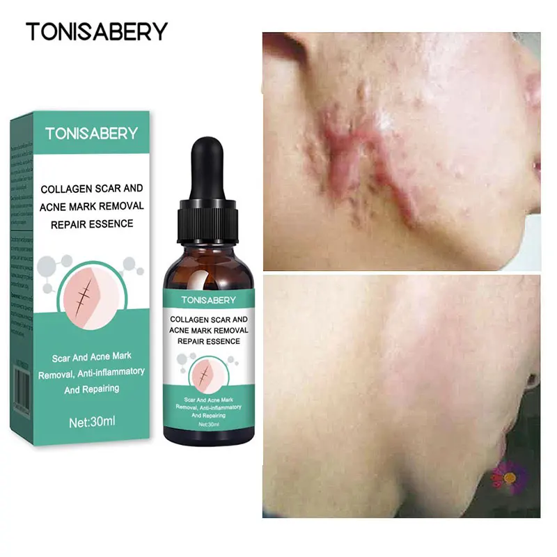 Восстанавливающая и укрепляющая сыворотка для кожи тела
Восстанавливающая и укрепляющая сыворотка для кожи тела