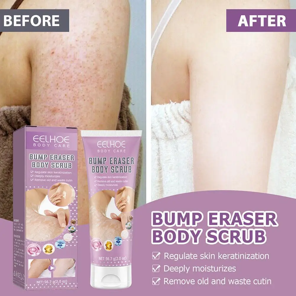 Keratosis Pilaris Cream For Strawberry Legs Removal Dark Spot KP Bump Eraser Body Scrub Smooth Lotion
Keratosis Pilaris Cream For Strawberry Legs Removal Dark Spot KP Bump Eraser Body Scrub Smooth Lotion