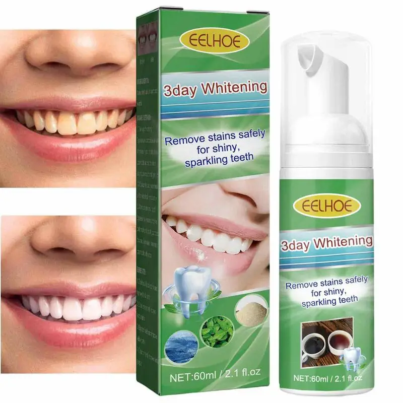 Tooth Cleaning Mousse Toothpaste Mouthwash Fresh Breath Tooth Stain Removal Brightening Whitening Bleaching Oral Hygiene Care
Tooth Cleaning Mousse Toothpaste Mouthwash Fresh Breath Tooth Stain Removal Brightening Whitening Bleaching Oral Hygiene Care
