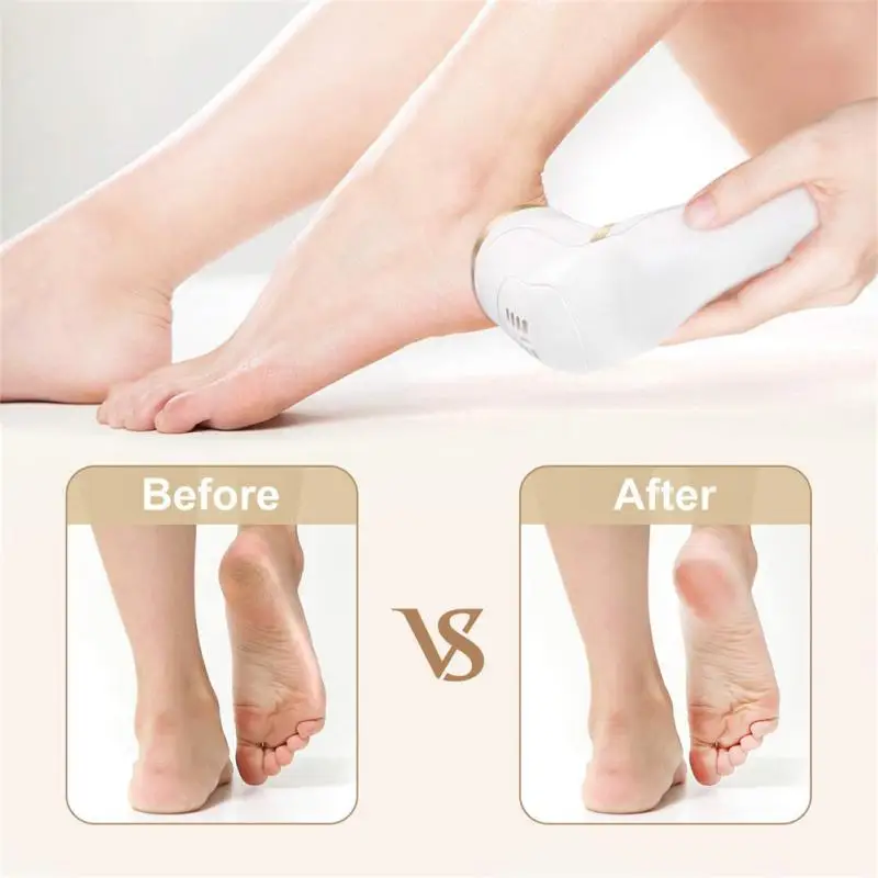 Electric Foot File Remover Protable USB Charging Pedicure Foot Care Tools With 3 Different Roller Head Dead Dry Skin Remover
Electric Foot File Remover Protable USB Charging Pedicure Foot Care Tools With 3 Different Roller Head Dead Dry Skin Remover