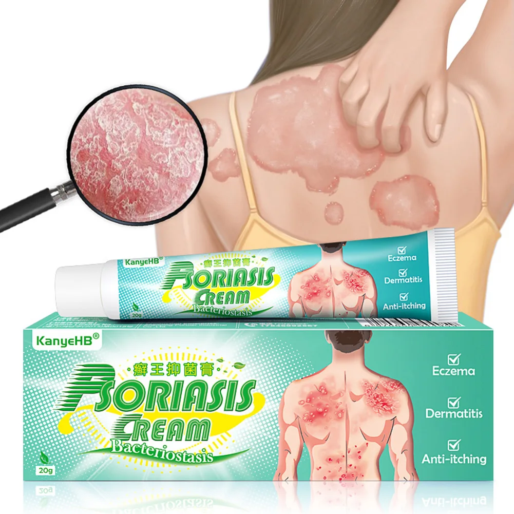 Psoriasis Cream Itch Relief Eczema Dermatitis Psoriasis Treatment Ointment Fungus Inhibition Cream For Hands Foot Skin
Psoriasis Cream Itch Relief Eczema Dermatitis Psoriasis Treatment Ointment Fungus Inhibition Cream For Hands Foot Skin