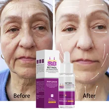Wrinkle Remove Face Serum Retinol Instant Facial Wrinkles Eliminator Reduces Fine Lines Anti-Aging Tighten Skin Care Cosmetics