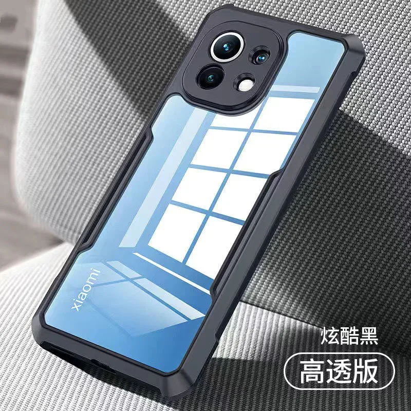 For Xiaomi Mi 11 11T Pro Mobile Phone Case For Xiaomi 11 Ultra Lite 11ultra Matte Frosted Anti-fall Lens Cover Airbag Phone Case
For Xiaomi Mi 11 11T Pro Mobile Phone Case For Xiaomi 11 Ultra Lite 11ultra Matte Frosted Anti-fall Lens Cover Airbag Phone Case