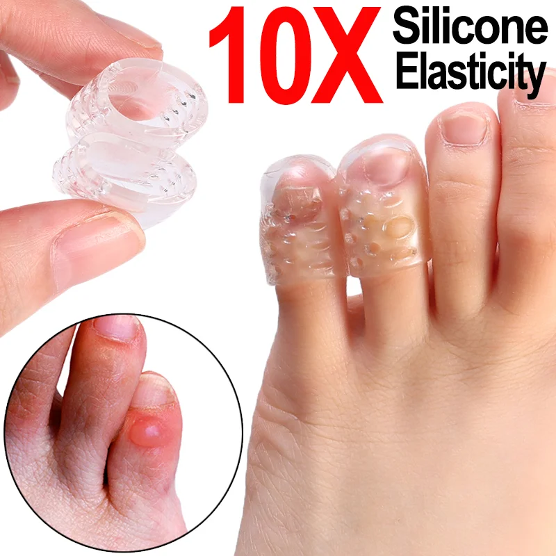 1-10Pcs Silicone Toe Protective Cover Anti-Friction Breathable Protector Prevents Blisters Toe Caps Covers Protectors Foot Care
1-10Pcs Silicone Toe Protective Cover Anti-Friction Breathable Protector Prevents Blisters Toe Caps Covers Protectors Foot Care