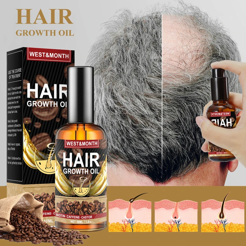 Fast Hair Loss Growth Caffeine Essential Oil Repair Damaged Hairless Alopecia High Hairline Bald Pate Baldhead Nourishing Lotion
Fast Hair Loss Growth Caffeine Essential Oil Repair Damaged Hairless Alopecia High Hairline Bald Pate Baldhead Nourishing Lotion