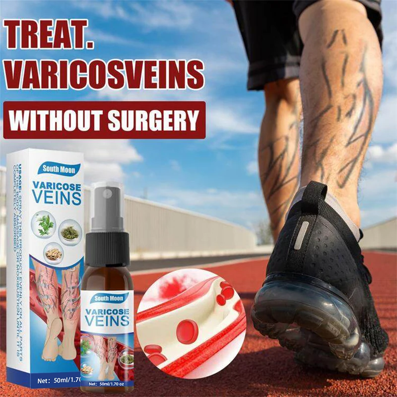relief phlebitis vasculitis remedies pain patches spider vein edema nerve pain earthworm legs varicose veins spray
relief phlebitis vasculitis remedies pain patches spider vein edema nerve pain earthworm legs varicose veins spray