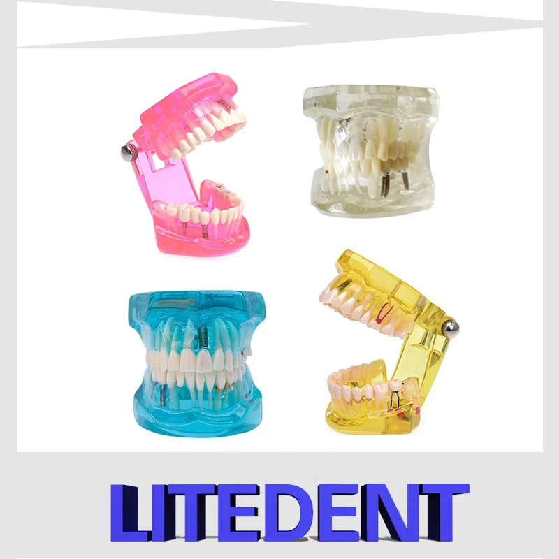 Инструмент для обучения в детском саду и начальной школе, Обучающие стоматологические модели для студентов, Обучающие формы для зубов
Инструмент для обучения в детском саду и начальной школе, Обучающие стоматологические модели для студентов, Обучающие формы для зубов