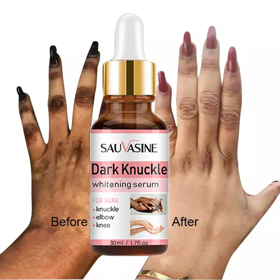Joint Deblackening Beauty Serum Lighten Melanin Knee Ankle Corner Brighten Skin Tone Armpit Whitening Rejuvenation Bleaching
Joint Deblackening Beauty Serum Lighten Melanin Knee Ankle Corner Brighten Skin Tone Armpit Whitening Rejuvenation Bleaching