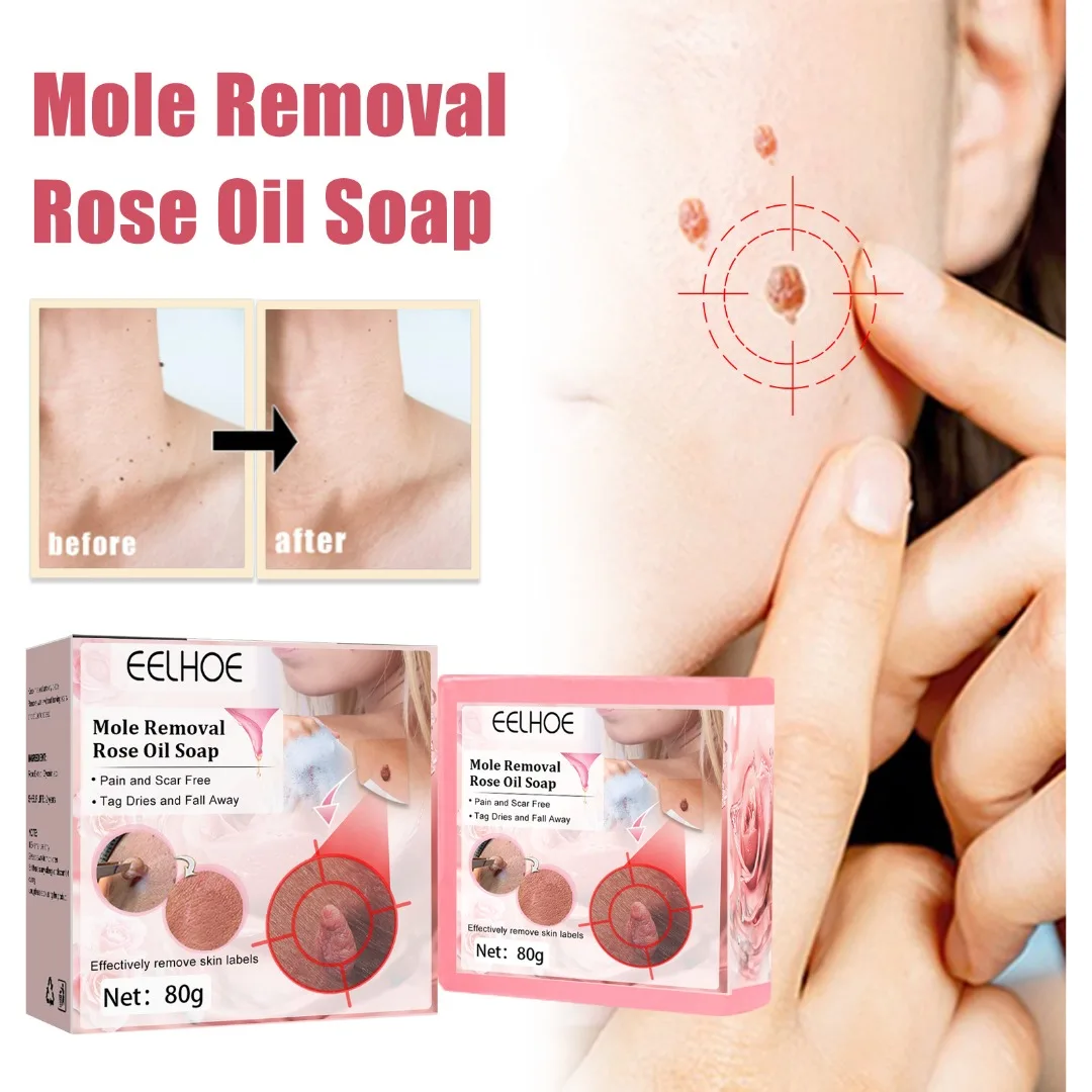 1 Pc 80g Mole Skin Tags Removal Rose Oil Soap Skin Tag Remover Treatment Body Skin Care for Women Men Any Skin Type Beauty
1 Pc 80g Mole Skin Tags Removal Rose Oil Soap Skin Tag Remover Treatment Body Skin Care for Women Men Any Skin Type Beauty