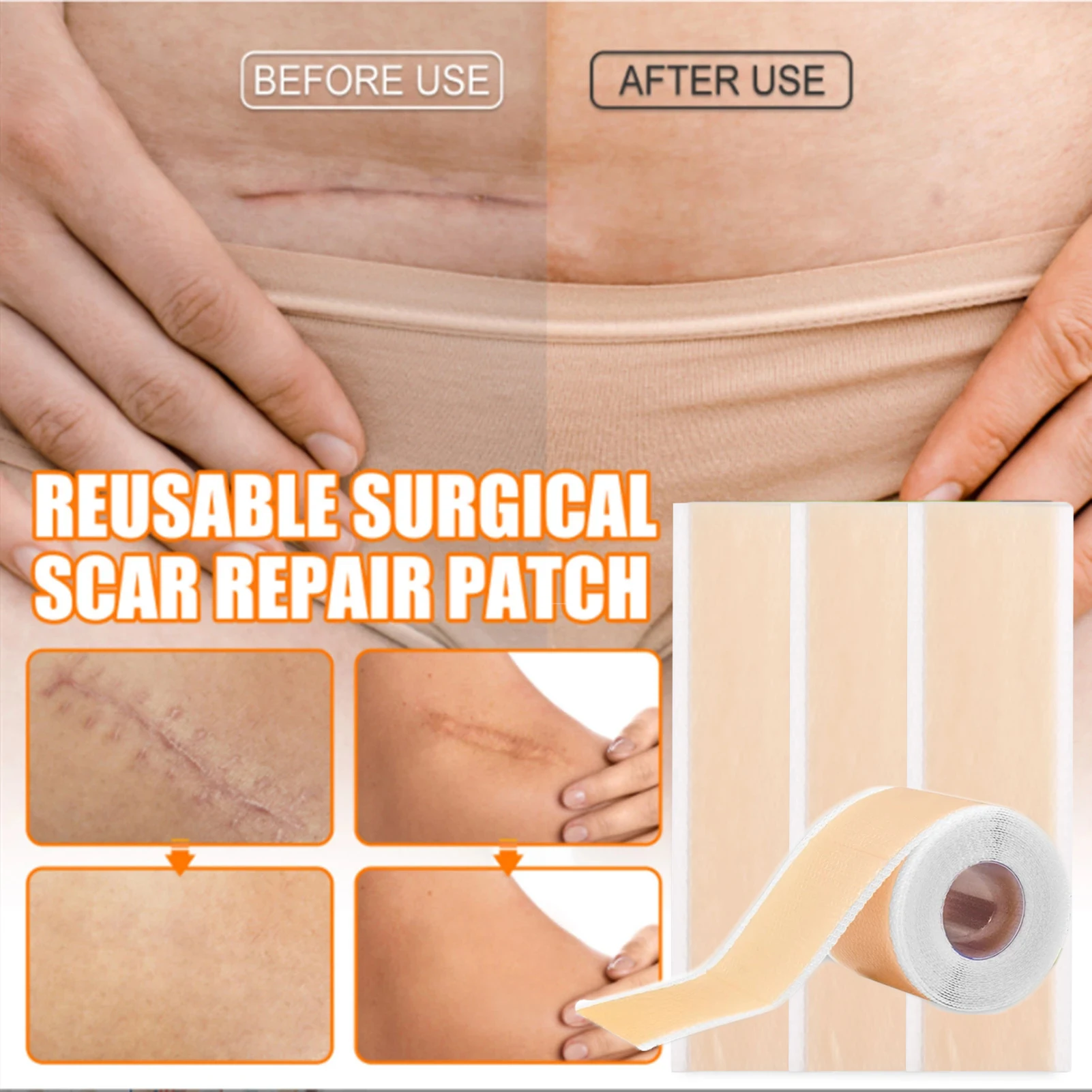 4x1 5/50 см хирургическое удаление шрамов силиконовый гелевый пластырь лечебная лента эффективный лист для лечения травм от акне лечение шрам...
4x1 5/50 см хирургическое удаление шрамов силиконовый гелевый пластырь лечебная лента эффективный лист для лечения травм от акне лечение шрам...