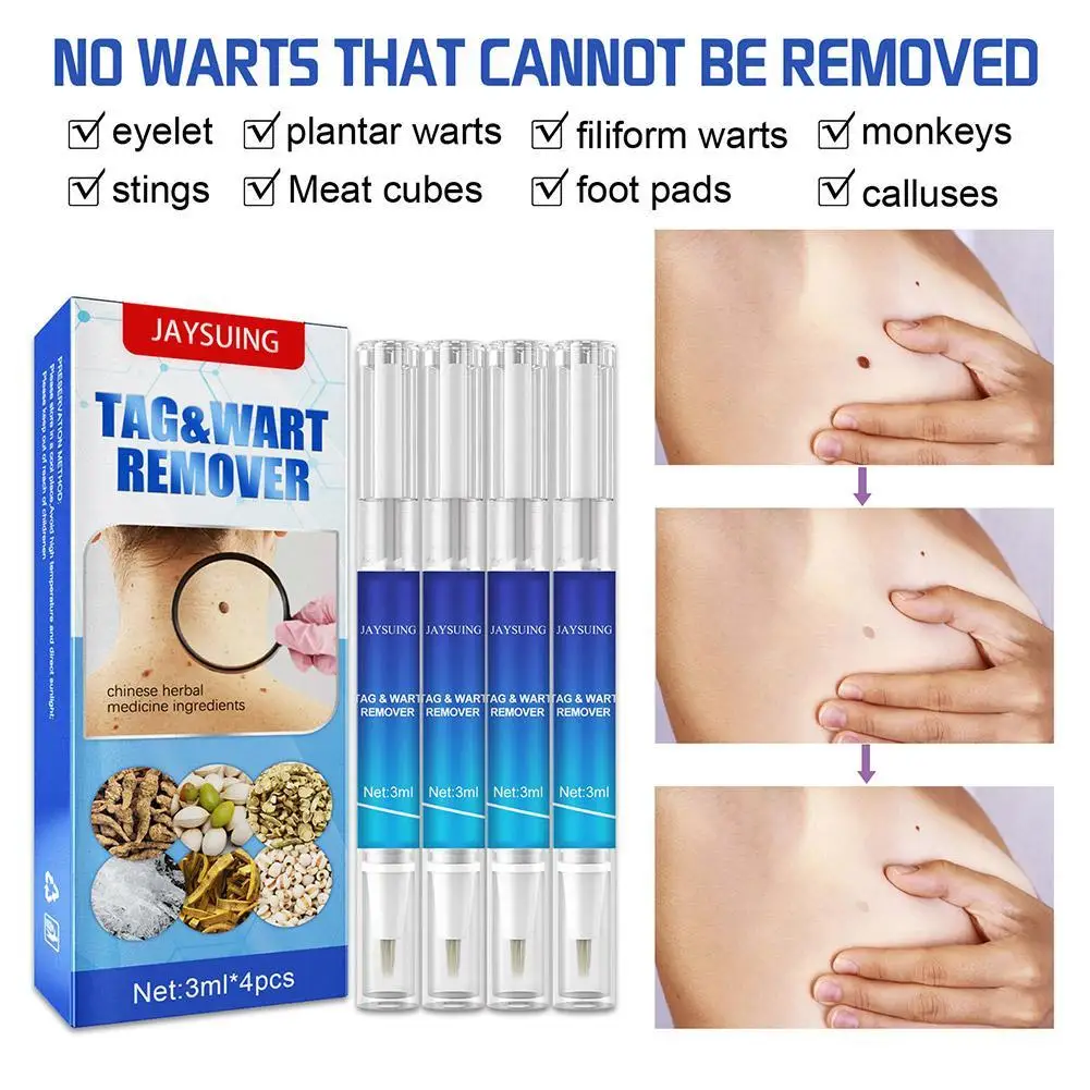 4pcs Skin Tag Remover For Mole Removal Mole Removal Fast Warts Fast Removal Wart Papilloma Removal Foot Corns Health Care
4pcs Skin Tag Remover For Mole Removal Mole Removal Fast Warts Fast Removal Wart Papilloma Removal Foot Corns Health Care