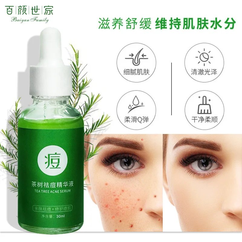 Tea Tree Acne Essence moisturizing removes acne Eliminate acne marks shrinks pores Control oil Skin care Free shipping
Tea Tree Acne Essence moisturizing removes acne Eliminate acne marks shrinks pores Control oil Skin care Free shipping