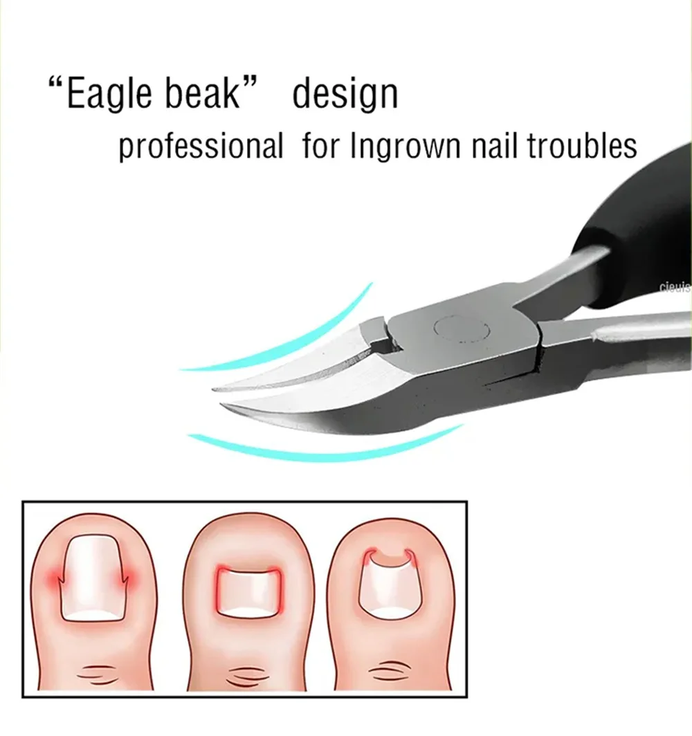 Paronychia Improved Stainless steel nail clippers trimmer Ingrown pedicure care professional Cutter nipper tools feet toenail
Paronychia Improved Stainless steel nail clippers trimmer Ingrown pedicure care professional Cutter nipper tools feet toenail