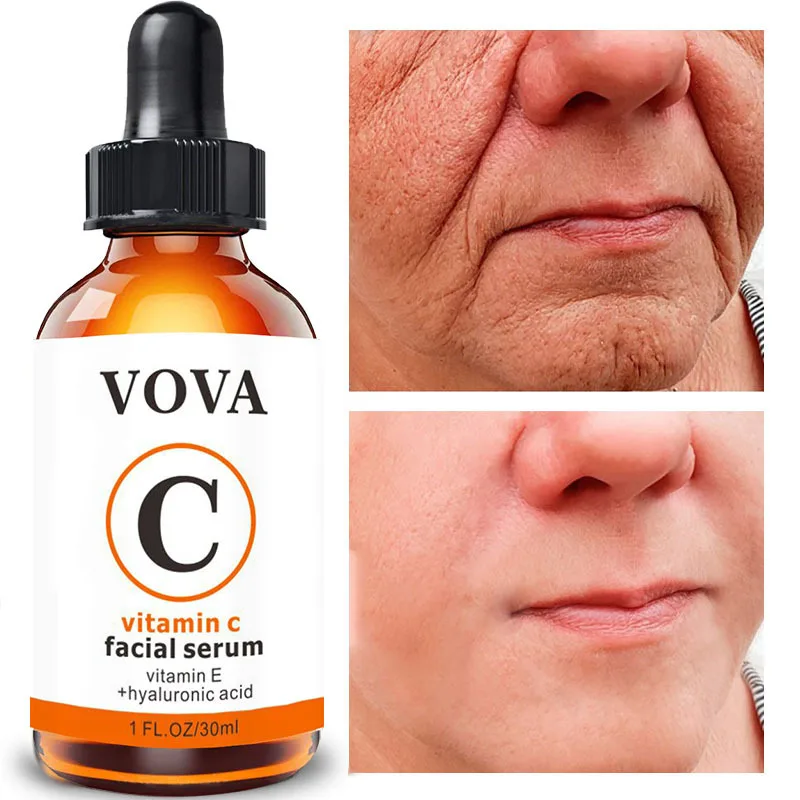 

Витамин C отбеливающая лицевая сыворотка, эффективное средство для удаления морщин, уход за кожей, гиалуроновая кислота, увлажнение, осветл...