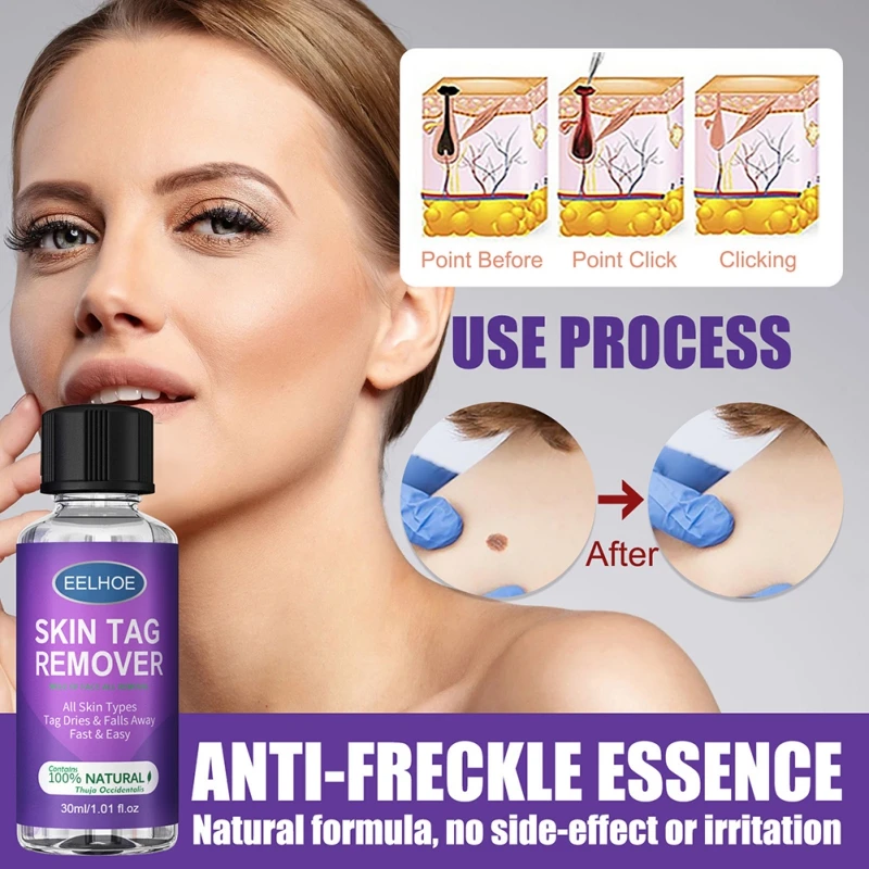 Remover Warts Treatment Meat Corn Skin Flat Wart Antibacterial Liquid Foot Calluses Skin Care Cream Flaw Removal
Remover Warts Treatment Meat Corn Skin Flat Wart Antibacterial Liquid Foot Calluses Skin Care Cream Flaw Removal