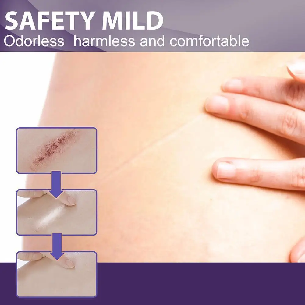 Scar Removal Patch Surgery Self-Adhesive Silicone Gel Tape Removal Scar Tape Therapy Patch For Acne Trauma Burn Scar Skin R I2L1
Scar Removal Patch Surgery Self-Adhesive Silicone Gel Tape Removal Scar Tape Therapy Patch For Acne Trauma Burn Scar Skin R I2L1