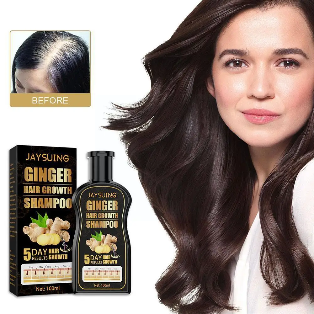 Shampoo Anti Hair Loss Shampoo Hair Care Products Prevents Scalp Treatments Thinning Hair For Men And Women 100 B4G9
Shampoo Anti Hair Loss Shampoo Hair Care Products Prevents Scalp Treatments Thinning Hair For Men And Women 100 B4G9
