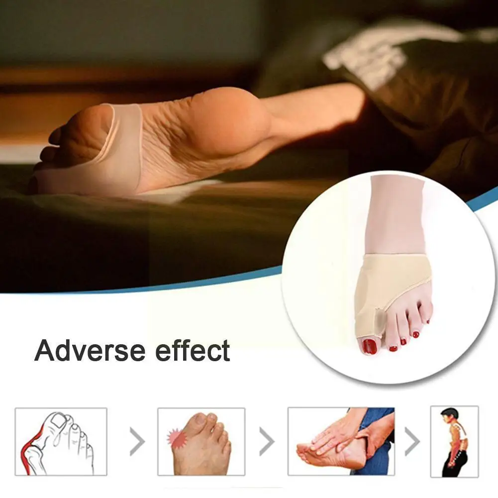 Bunion Corrector Hallux Valgus Foot Pedicure Sock Bone Version Splint Foot Separators Correction Toe Straightener Thumb Upd G2c5
Bunion Corrector Hallux Valgus Foot Pedicure Sock Bone Version Splint Foot Separators Correction Toe Straightener Thumb Upd G2c5