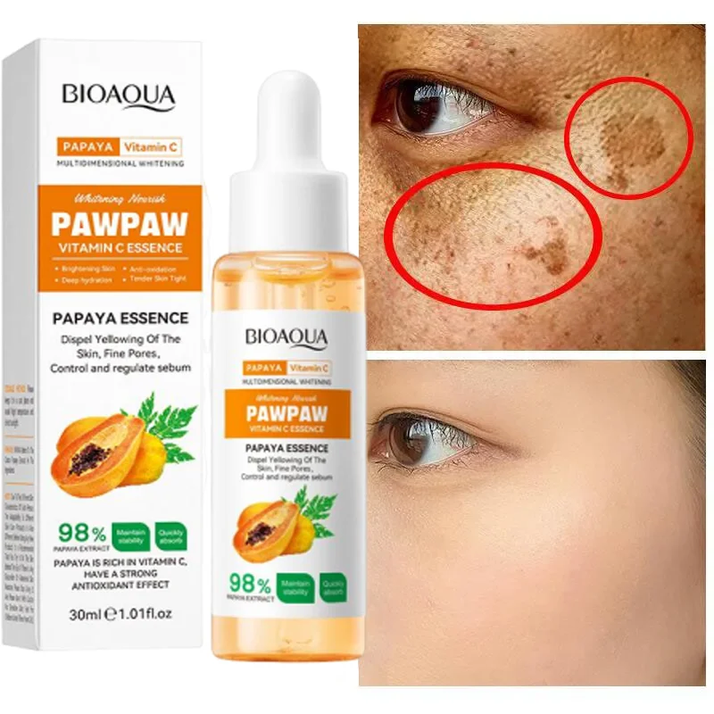 

Whiten Freckle Papaya Essence Effective Remove Melasma Dark Spots Fade Melanin Brightening Serum Lotion Beauty Health Skin Care