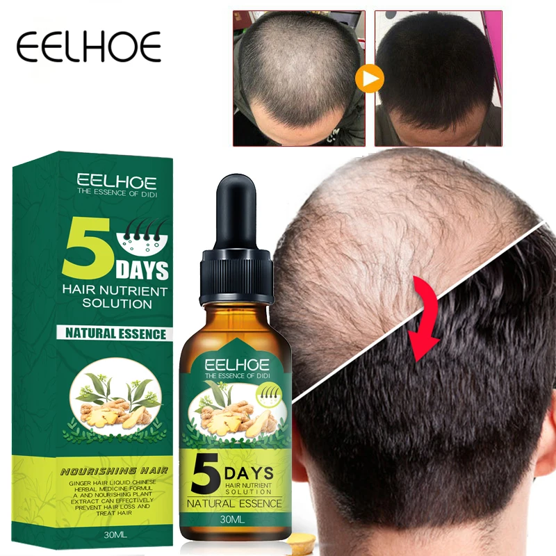 5 Days Hair Growth Products Ginger Anti Hair Loss Spray Oil for Men Hair Beard Growth Thicker Longer Treatment Damaged Hair Care
5 Days Hair Growth Products Ginger Anti Hair Loss Spray Oil for Men Hair Beard Growth Thicker Longer Treatment Damaged Hair Care