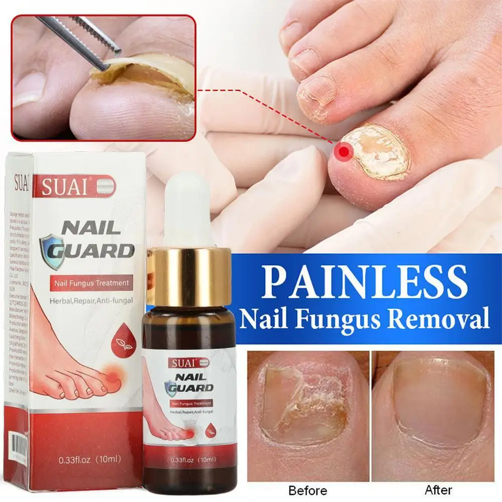 10ml Nail Fungal Treatment Feet Care Essence Nail Foot Toe Nail Fungus Removal Gel Anti Infection Paronychia Onychomycosis
10ml Nail Fungal Treatment Feet Care Essence Nail Foot Toe Nail Fungus Removal Gel Anti Infection Paronychia Onychomycosis