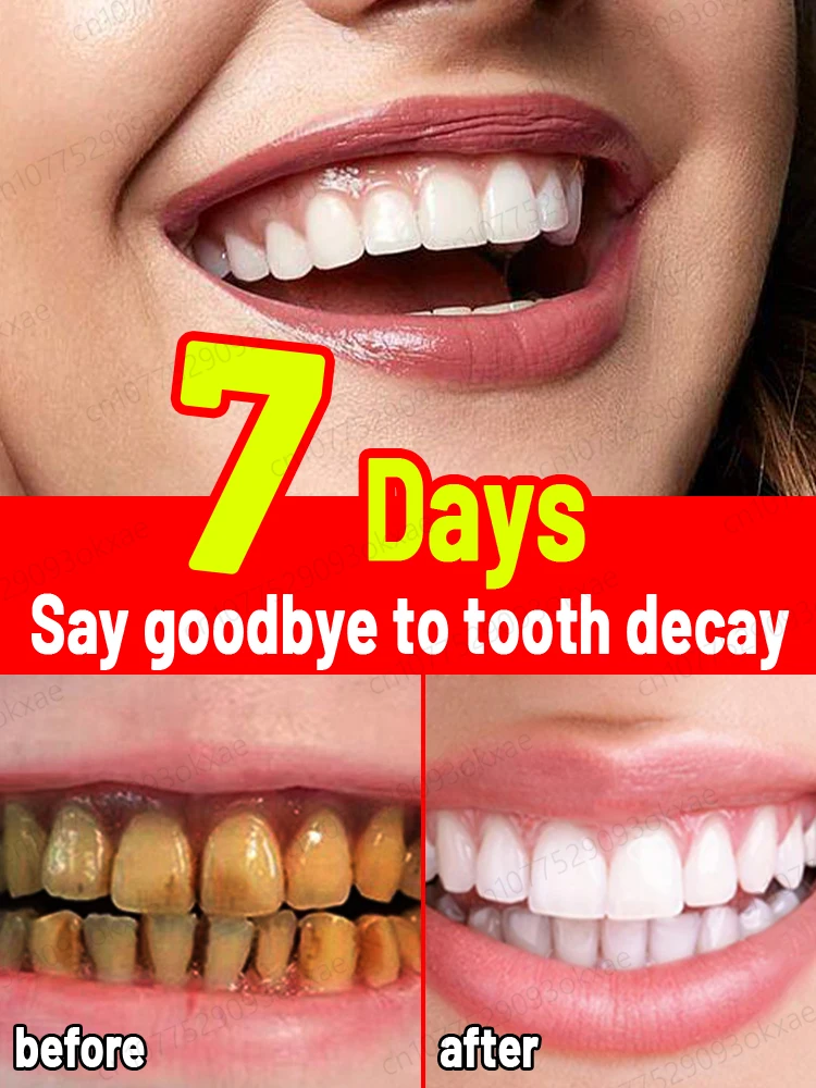 

Отбеливание зубов, анти-кариес, кариес, восстановление свежего неприятного дыхания, удаление зубного налета, зубная боль, снятие периодонтита