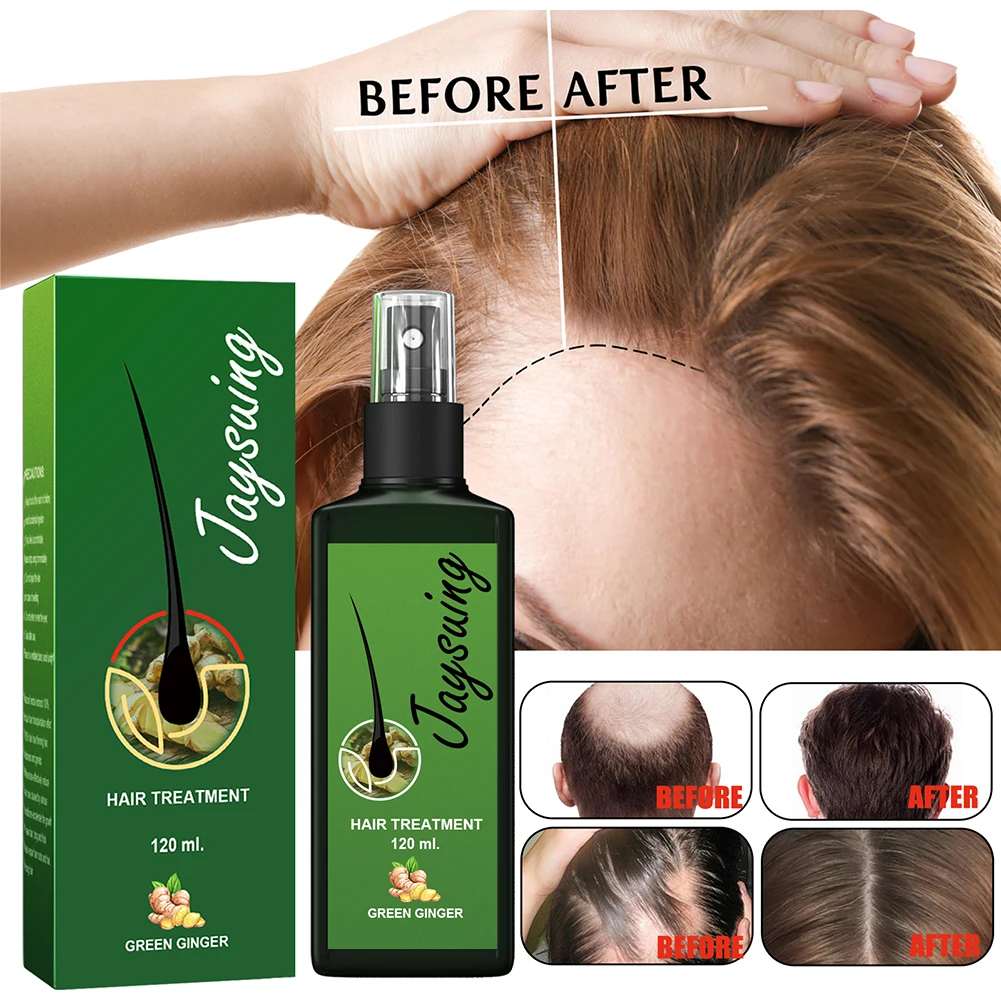 

120ml/30ml Hair Care Hair Growth Essential Oils Essence Hair Nutrient Solution Hair Loss Liquid Beauty Dense Hair Growth Serum