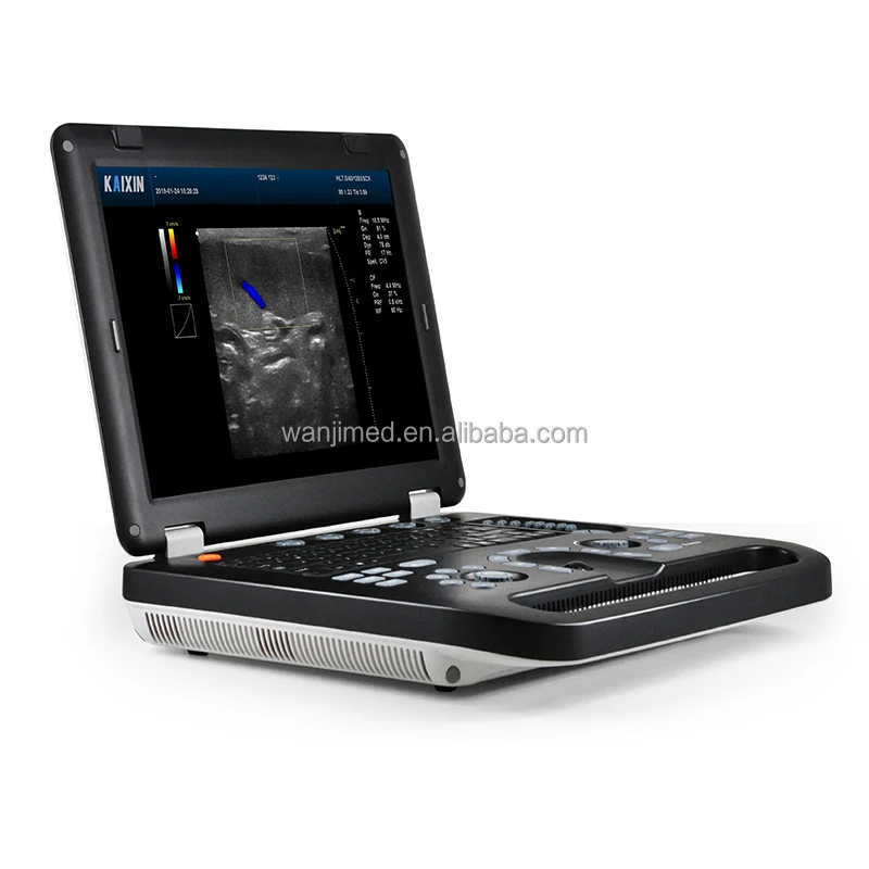 Portable ultrasound for animals digital laptop test veterinary handheld scanner
Portable ultrasound for animals digital laptop test veterinary handheld scanner