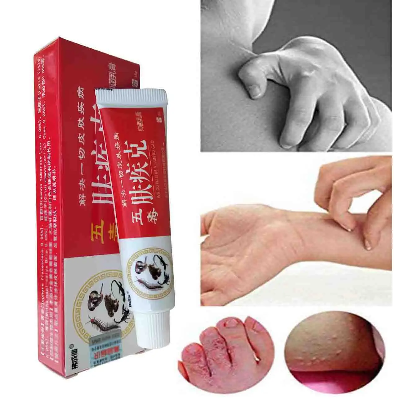

Rash Treatment Psoriasis Ointment Natural Chinese Herbal Eczema, Creams Dermatitis Pruritus Anti-Itch External Use Only FJK