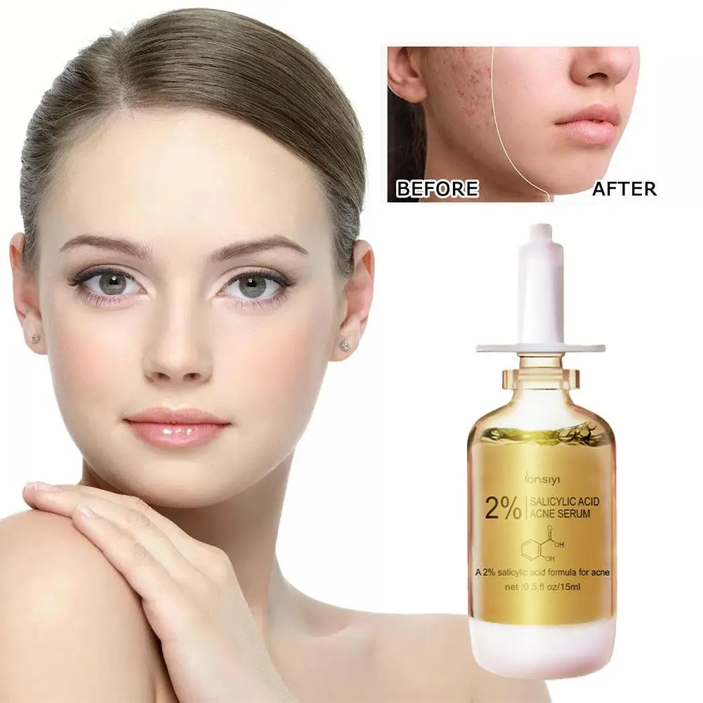 Acid Acne Removal Salicylic Serum Effective Acne Treatment Control Care Moisturizing Pore Repair Scar Oil Spots Skin 15ml S Z2T9 
Acid Acne Removal Salicylic Serum Effective Acne Treatment Control Care Moisturizing Pore Repair Scar Oil Spots Skin 15ml S Z2T9