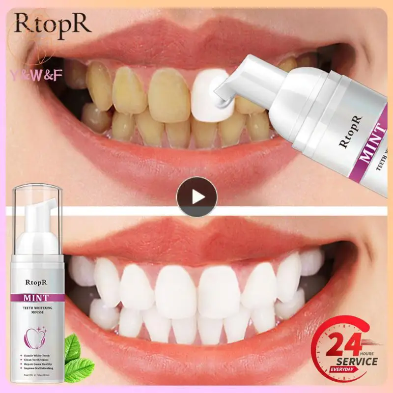 1~10PCS Teeth Whitening Mousse Tooth Cleaning Remove Stains White Teeth Oral Hygiene Toothpaste Bleaching Clean
1~10PCS Teeth Whitening Mousse Tooth Cleaning Remove Stains White Teeth Oral Hygiene Toothpaste Bleaching Clean