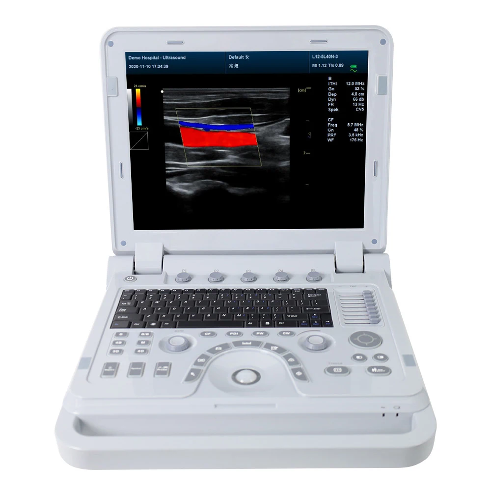 CONTEC CMS1700A handheld human Color Doppler Ultrasonic Diagnostic System digital ultrasound machine
CONTEC CMS1700A handheld human Color Doppler Ultrasonic Diagnostic System digital ultrasound machine